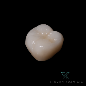 corona dental